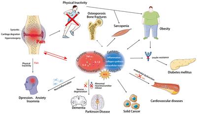 Exploration beyond osteoarthritis: the association and mechanism of its related comorbidities